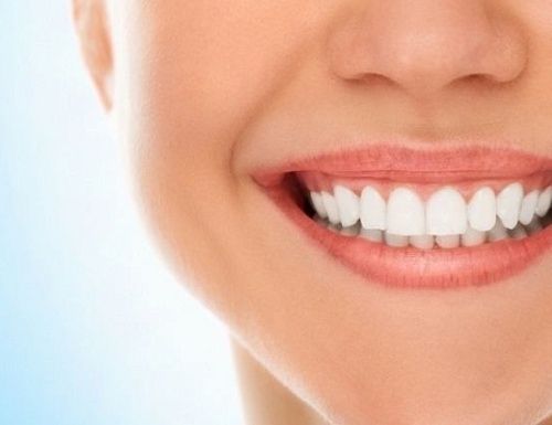 Что дает полировка зубов?