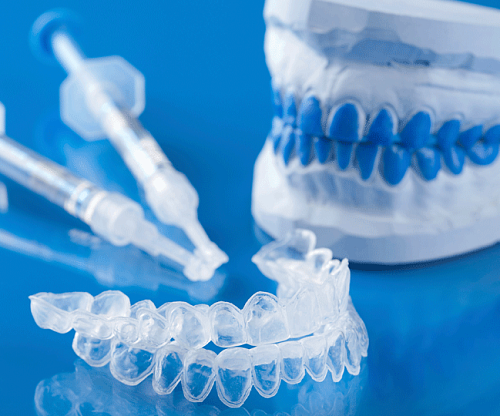 Как работают каппы для отбеливания зубов?