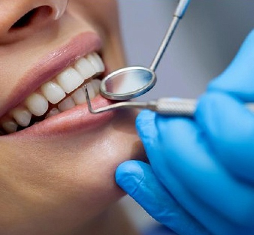 Лечение кариеса эмали